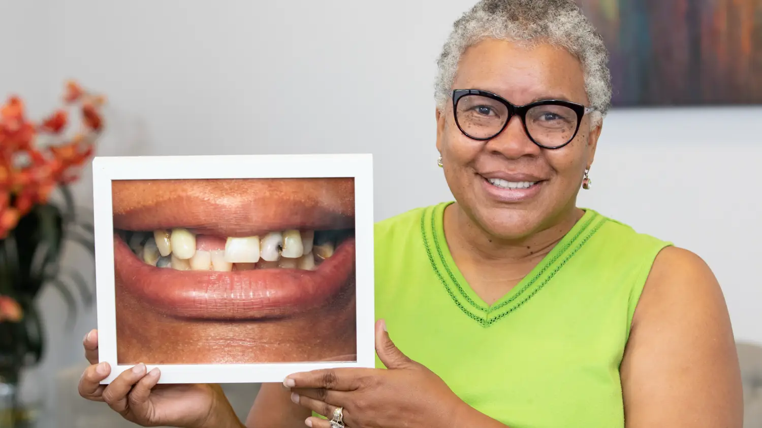 Before & Afters | Smile Standard